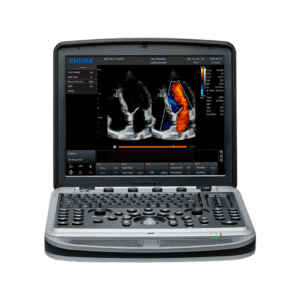 Chison Sonobook 8